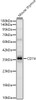 Western blot analysis of Mouse thymus, using CD74 Rabbit pAb (CAB24487) at 1:900 dilution. Secondary antibody: HRP Goat Anti-Rabbit IgG (H+L) at 1:10000 dilution. Lysates/proteins: 25ug per lane. Blocking buffer: 3% nonfat dry milk in TBST.