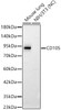 Western blot analysis of various lysates, using CD105 Rabbit pAb (CAB24488) at 1:2000 dilution. Secondary antibody: HRP Goat Anti-Rabbit IgG (H+L) at 1:10000 dilution. Lysates/proteins: 25ug per lane. Blocking buffer: 3% nonfat dry milk in TBST.
