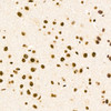 Immunohistochemistry analysis of ZNF324 in paraffin-embedded rat brain tissue using ZNF324 Rabbit pAb (CAB24498) at a dilution of  1:100 (40x lens).  High pressure antigen retrieval was performed with 0. 01 M citrate buffer (pH 6. 0) prior to IHC staining.