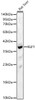 Western blot analysis of Rat liver, using KLF1 Rabbit pAb (CAB24503) at 1:1000 dilution. Secondary antibody: HRP Goat Anti-Rabbit IgG (H+L) at 1:10000 dilution. Lysates/proteins: 25ug per lane. Blocking buffer: 3% nonfat dry milk in TBST.