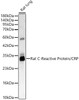 Western blot analysis of Rat lung, using Rat C-Reactive Protein/CRP Rabbit pAb (CAB24504) at 1:2000 dilution. Secondary antibody: HRP Goat Anti-Rabbit IgG (H+L) at 1:10000 dilution. Lysates/proteins: 25ug per lane. Blocking buffer: 3% nonfat dry milk in TBST.