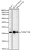 Western blot analysis of various lysates, using TMEM176B Rabbit pAb (CAB24509) at 1:2000 dilution. Secondary antibody: HRP Goat Anti-Rabbit IgG (H+L) at 1:10000 dilution. Lysates/proteins: 25ug per lane. Blocking buffer: 3% nonfat dry milk in TBST.