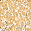 Immunohistochemistry analysis of paraffin-embedded human liver using SLC27A6 Rabbit pAb (CAB24512) at dilution of 1:50 (40x lens). Perform high pressure antigen retrieval with 10 mM citrate buffer pH 6. 0 before commencing with IHC staining protocol.