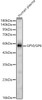 Western blot analysis of Human plasma, using GPVI/GP6 Rabbit pAb (CAB24524) at 1:2000 dilution. Secondary antibody: HRP Goat Anti-Rabbit IgG (H+L) at 1:10000 dilution. Lysates/proteins: 25ug per lane. Blocking buffer: 3% nonfat dry milk in TBST.