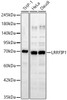 Western blot analysis of various lysates, using LRRFIP1 Rabbit pAb (CAB24530) at 1:1000 dilution. Secondary antibody: HRP Goat Anti-Rabbit IgG (H+L) at 1:10000 dilution. Lysates/proteins: 25ug per lane. Blocking buffer: 3% nonfat dry milk in TBST.