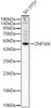 Western blot analysis of SH-SY5Y, using [KO Validated] ZNF566 Rabbit pAb (CAB24543) at 1:800 dilution. Secondary antibody: HRP Goat Anti-Rabbit IgG (H+L) at 1:10000 dilution. Lysates/proteins: 25ug per lane. Blocking buffer: 3% nonfat dry milk in TBST.