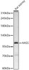 Western blot analysis of Rat kidney, using AASS Rabbit pAb (CAB24544) at 1:100 dilution. Secondary antibody: HRP Goat Anti-Rabbit IgG (H+L) at 1:10000 dilution. Lysates/proteins: 25ug per lane. Blocking buffer: 3% nonfat dry milk in TBST.