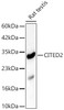 Western blot analysis of lysates from Rat testis, using CITED2 Rabbit pAb (CAB24662) at 1:2000 dilution. Secondary antibody: HRP Goat Anti-Rabbit IgG (H+L) at 1:10000 dilution. Lysates/proteins: 25ug per lane. Blocking buffer: 3% nonfat dry milk in TBST.