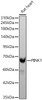 Western blot analysis of lysates from Rat heart using PINK1 Rabbit pAb(CAB24745) at 1:1000 dilution. Secondary antibody:HRP Goat Anti-Rabbit IgG (H+L) at 1:10000 dilution. Lysates/proteins: 25 μg per lane. Blocking buffer: 3% nonfat dry milk in TBST. Detection:ECL Basic Kit (RM00020). Exposuretime:15s.