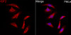 Immunofluorescence analysis of HeLa cells using IGF2 Rabbit pAb (CAB24842) at dilution of 1:100 (40x lens). Secondary antibody: Cy3 Goat Anti-Rabbit IgG (H+L) (AS007) at 1:500 dilution. Blue: DAPI for nuclear staining.