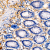 Immunohistochemistry analysis of Human Pro-Collagen I alpha in paraffin-embedded human colon tissue using Human Pro-Collagen I alpha Rabbit pAb (CAB24863) at a dilution of 1:200 (40x lens). High pressure antigen retrieval was performed with 0. 01 M citrate buffer (pH 6. 0) prior to IHC staining.