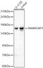 Western blot analysis of various lysates using SMARCAD1 Rabbit pAb (CAB24882) at 1:1000 dilution. Secondary antibody:HRP Goat Anti-Rabbit IgG (H+L) at 1:10000 dilution. Lysates / proteins: 25 μg per lane. Blocking buffer: 3 % nonfat dry milk in TBST. Detection:ECL Basic Kit (RM00020). Exposuretime: 1s.