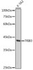 Western blot analysis of extracts of K-562 cells, using TRIB3 antibody (CAB3523) at 1:1000 dilution. Secondary antibody: HRP Goat Anti-Rabbit IgG (H+L) at 1:10000 dilution. Lysates/proteins: 25μg per lane. Blocking buffer: 3% nonfat dry milk in TBST.