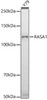 Western blot analysis of extracts of various cell lines, using (CAB4876) at 1:500 dilution. Secondary antibody: HRP Goat Anti-Rabbit IgG (H+L) at 1:10000 dilution. Lysates/proteins: 25μg per lane. Blocking buffer: 3% nonfat dry milk in TBST.