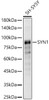 Western blot analysis of SH-SY5Y, using SYN1 Rabbit pAb (CAB5247) at 1:10000 dilution. Secondary antibody: HRP Goat Anti-Rabbit IgG (H+L) at 1:10000 dilution. Lysates/proteins: 25μg per lane. Blocking buffer: 3% nonfat dry milk in TBST.