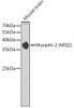 Western blot analysis of extracts of mouse brain, using Musashi-2 (Musashi-2 (MSI2)) antibody (CAB6004). Secondary antibody: HRP Goat Anti-Rabbit IgG (H+L) at 1:10000 dilution. Lysates/proteins: 25μg per lane. Blocking buffer: 3% nonfat dry milk in TBST.