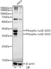 Western blot analysis of extracts of HeLa cells, using Phospho-JunD-S255 antibody (CABP1323) at1:2000 dilution. Hela cells were treated by CIP(20uL/400ul) at 37℃ for 1 hour. Secondary antibody: HRP Goat Anti-Rabbit IgG (H+L) at 1:10000 dilution. Lysates/proteins: 25μg per lane. Blocking buffer: 3% nonfat dry milk in TBST.