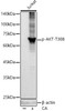 Western blot analysis of extracts of Jurkat, using Phospho-Akt-T308 antibody (CABP1332) at1:2000 dilution. Jurkat cells were treated by Calyculin A (100 nM) at 37℃ for 30 minutes. Secondary antibody: HRP Goat Anti-Rabbit IgG (H+L) at 1:10000 dilution. Lysates/proteins: 25μg per lane. Blocking buffer: 3% nonfat dry milk in TBST.