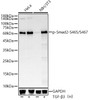 Western blot analysis of extracts of various lysates, using Phospho-Smad2-S465/S467 antibody (CABP1342) at1:2000 dilution. HeLa and NIH/3T3 were treated by TGF-β3（H） (200 ng/mL) at 37℃ for 30 minutes after serum-starvation overnight. Secondary antibody: HRP Goat Anti-Rabbit IgG (H+L) at 1:10000 dilution. Lysates/proteins: 25μg per lane. Blocking buffer: 3% nonfat dry milk in TBST.
