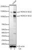 Western blot analysis of extracts of Jurkat cells, using Phospho-HDAC4-S632 antibody (CABP1344) at1:2000 dilution. Jurkat cells were treated by Calyculin A (100 nM) at 37℃ for 30 minutes. Secondary antibody: HRP Goat Anti-Rabbit IgG (H+L) at 1:10000 dilution. Lysates/proteins: 25μg per lane. Blocking buffer: 3% nonfat dry milk in TBST.