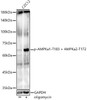 Western blot analysis of extracts of C2C12, using Phospho-AMPKa1-T183 + AMPKa2-T172 antibody (CABP1345) at1:1000 dilution. C2C12 cells were treated by oligomycin (0. 5 uM) at 37℃ for 30 minutes. Secondary antibody: HRP Goat Anti-Rabbit IgG (H+L) at 1:10000 dilution. Lysates/proteins: 25μg per lane. Blocking buffer: 3% nonfat dry milk in TBST.