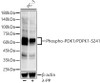 Western blot analysis of various lysates, using Phospho-PDK1/PDPK1-S241 antibody (CABP1357) at1:2000 dilution. PC-3 cells were treated by λ-PP mixed solution (1ul) at 30℃ for 30 minutes. Secondary antibody: HRP Goat Anti-Rabbit IgG (H+L) at 1:10000 dilution. Lysates/proteins: 25μg per lane. Blocking buffer: 3% nonfat dry milk in TBST.