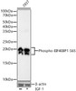 Western blot analysis of 293T, using Phospho-EIF4EBP1-S65 antibody (CABP1363) at 1:20000 dilution. 293T cells were treated by IGF-1 (50 ng/ml) at 37℃ for 5 minutes after serum-starvation overnight. Secondary antibody: HRP Goat Anti-Rabbit IgG (H+L) at 1:10000 dilution. Lysates/proteins: 25μg per lane. Blocking buffer: 3% nonfat dry milk in TBST.