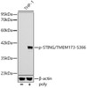 Western blot analysis of THP-1, using Phospho-STING/TMEM173-S366 antibody (CABP1369) at 1:1000 dilution. THP-1 cells were transfection with poly(dA:dT) (5μg/mL) for 3 hours. Secondary antibody: HRP Goat Anti-Rabbit IgG (H+L) at 1:10000 dilution. Lysates/proteins: 25μg per lane. Blocking buffer: 3% nonfat dry milk in TBST.
