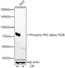 Western blot analysis of 293T cells, using Phospho-PKC alpha-T638 antibody (CABP1376) at 1:7000 dilution. 293T cells were treated by CIP(20uL/400ul) at 37℃ for 1 hour. Secondary antibody: HRP Goat Anti-Rabbit IgG (H+L) at 1:10000 dilution. Lysates/proteins: 25μg per lane. Blocking buffer: 3% nonfat dry milk in TBST.