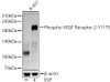Western blot analysis of A-431 lysates, using Phospho-VEGF Receptor 2-Y1175 antibody (CABP1385) at 1:3000 dilution. A-431 cells were treated by EGF (100 ng/ml) at 37℃ for 30 minutes after serum-starvation overnight. Secondary antibody: HRP Goat Anti-Rabbit IgG (H+L) at 1:10000 dilution. Lysates/proteins: 25μg per lane. Blocking buffer: 3% nonfat dry milk in TBST.