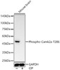Western blot analysis of various lysates, using Phospho-Camk2a-T286 antibody (CABP1386) at 1:5000 dilution. Mouse brain cells were treated by CIP(20uL/400ul) at 37℃ for 1 hour. Secondary antibody: HRP Goat Anti-Rabbit IgG (H+L) at 1:10000 dilution. Lysates/proteins: 25μg per lane. Blocking buffer: 3% nonfat dry milk in TBST.