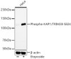 Western blot analysis of HeLa, using Phospho-KAP1/TRIM28-S824 antibody (CABP1393) at 1:5000 dilution. HeLa cells were treated by Etoposide (25 uM) at 37℃ for 5 hours. Secondary antibody: HRP Goat Anti-Rabbit IgG (H+L) at 1:10000 dilution. Lysates/proteins: 25μg per lane. Blocking buffer: 3% nonfat dry milk in TBST.
