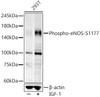 Western blot analysis of 293T lysates, using Phospho-eNOS-S1177 antibody (CABP1404) at 1:7000 dilution. 293T cells were treated by IGF-1 (50 ng/ml) at 37℃ for 5 minutes after serum-starvation overnight. Secondary antibody: HRP Goat Anti-Rabbit IgG (H+L) at 1:10000 dilution. Lysates/proteins: 25μg per lane. Blocking buffer: 3% nonfat dry milk in TBST.