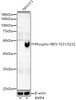 Western blot analysis of NIH/3T3, using Phospho-Smad5-S465 Rabbit mAb (CABP1411) at 1:2000 dilution. NIH/3T3 cells were treated by BMP4(50ng/ml) at 37℃ for 6 hours. Secondary antibody: HRP Goat Anti-Rabbit IgG (H+L) at 1:10000 dilution. Lysates/proteins: 25μg per lane. Blocking buffer: 3% nonfat dry milk in TBST.