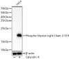 Western blot analysis of HeLa, using Phospho-Myosin Light Chain 2-S19 Rabbit mAb (CABP1433) at 1:1000 dilution. HeLa cells were treated by Calyculin A (100 nM) at 37℃ for 30 minutes after serum-starvation overnight. Secondary antibody: HRP Goat Anti-Rabbit IgG (H+L) at 1:10000 dilution. Lysates/proteins: 25μg per lane. Blocking buffer: 3% nonfat dry milk in TBST.