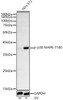 Western blot analysis of extracts of NIH/3T3, using Phospho-p38 MAPK-T180 Rabbit pAb (CABP1434) at 1:500 dilution. NIH/3T3 cells were treated by UV at room temperature for 15-30 minutes. Secondary antibody: HRP Goat Anti-Rabbit IgG (H+L) at 1:10000 dilution. Lysates/proteins: 25μg per lane. Blocking buffer: 3% nonfat dry milk in TBST.