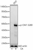 Western blot analysis of 293T, using Phospho-Chk1-S280 Rabbit mAb (CABP1444) at 1:2000 dilution. 293T cells were treated by Calyculin A (100 nM) at 37℃ for 30 minutes after serum-starvation overnight. Secondary antibody: HRP Goat Anti-Rabbit IgG (H+L) at 1:10000 dilution. Lysates/proteins: 25μg per lane. Blocking buffer: 3% nonfat dry milk in TBST.
