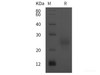 HumanFSHa/CGA Recombinant Protein (His tag)