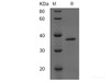 Human Cathepsin S/CTSS Recombinant Protein (His tag)