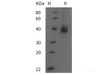 Mouse DKK1 Recombinant Protein (His tag)