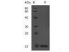 Rat BMG/β2-MG Recombinant Protein (His tag)