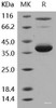 Human IL-8/CXCL8 Recombinant Protein (aa 28-99, Fc Tag)