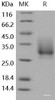 Human CD147/Basigin Recombinant Protein (His Tag)