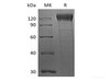 Recombinant Human Integrin Beta-1/ITGB1 (C-6His)