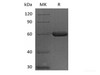Recombinant Human FGL1 (C-Fc)
