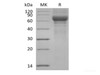 Recombinant Human Vitronectin/VTN (N-Truncated, C-6His)