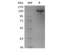 Recombinant Human Tie-2 (C-Fc)