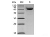 Recombinant Human LAG-3/CD233 (C-6His-Avi) Biotinylated