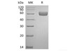 Recombinant Human Serpin A7/TBG (C-6His)