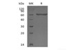 Recombinant Human Galectin-9/LGALS9 (N-GST)